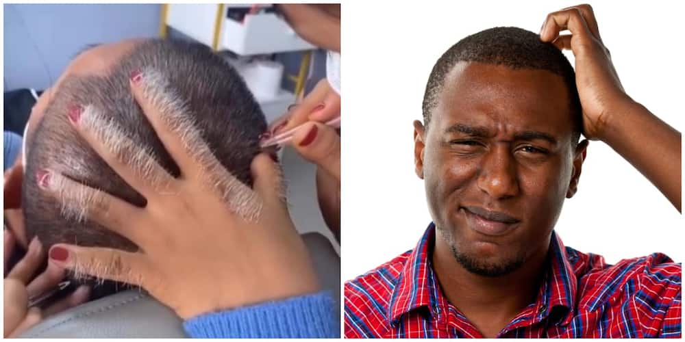 Mixed Reactions to Video of Man Undergoing Grey Hair Removal: 