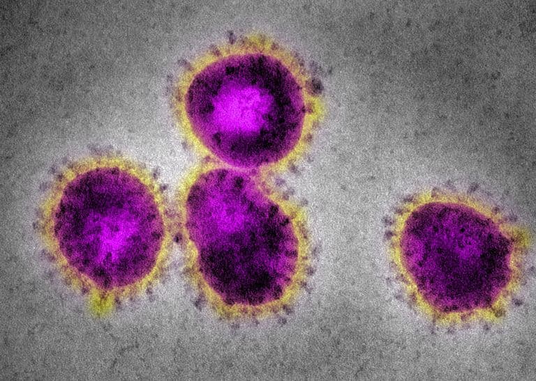 Coronavirus: Everything you need to know about virus killing people in China