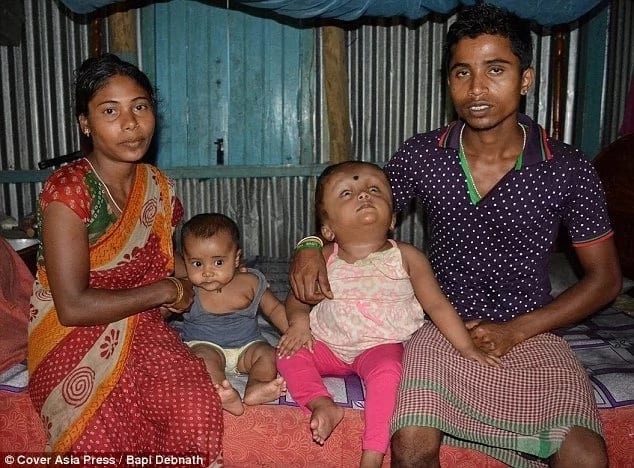 Baby born with hydrocephalus undergoes life-saving operation