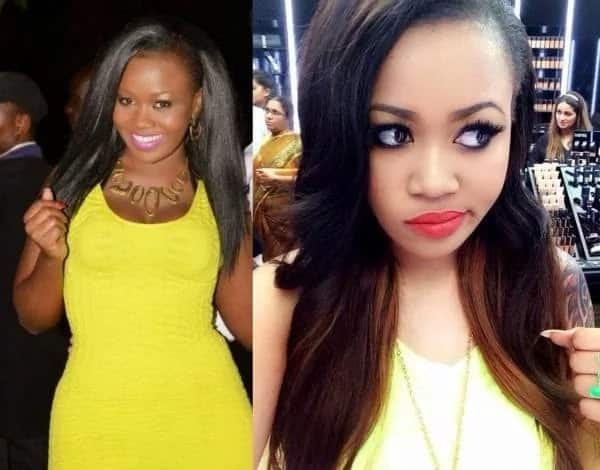Vera Sidika Before and After Skin Lightening Pictures