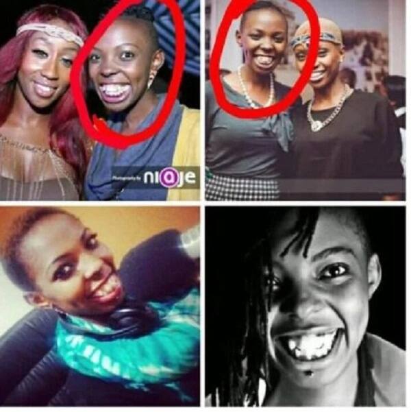 Adelle Onyango teeth pics