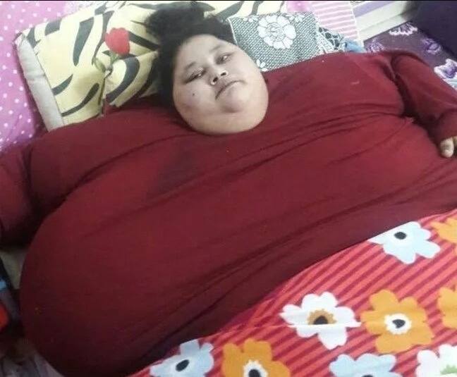 Fattest woman in the world that weighs shocking 500 kilograms begins her journey to get normal (photos) Fattest woman in the world that weighs shocking 500 kilograms begins her journey to get normal (photos)