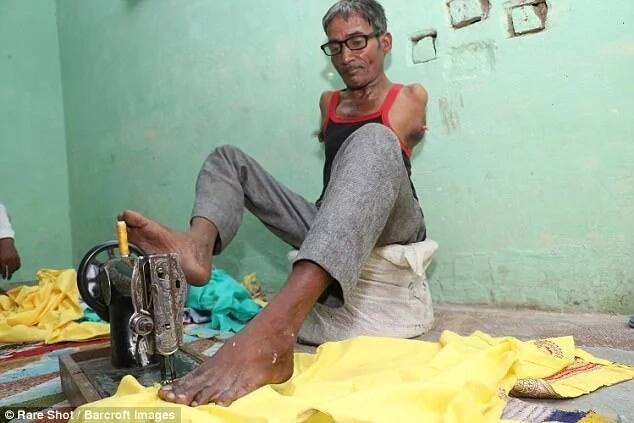 Inspirational: Madan Lal has defied the odds. Photo: Barcroft Images