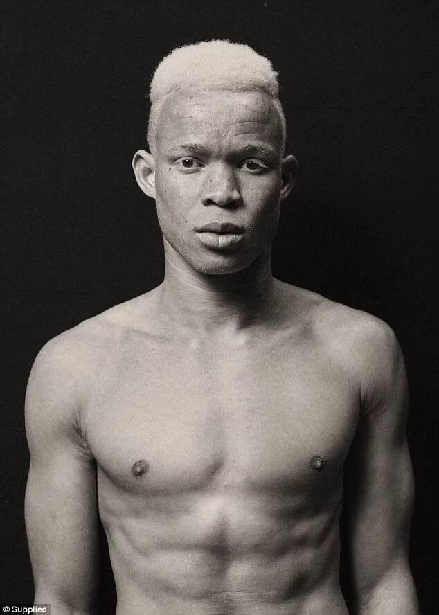 This Albino teen fled persecution and WAR to become a rising fashion model (photos)