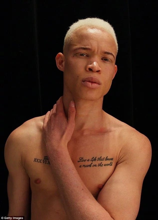 This Albino teen fled persecution and WAR to become a rising fashion model (photos)