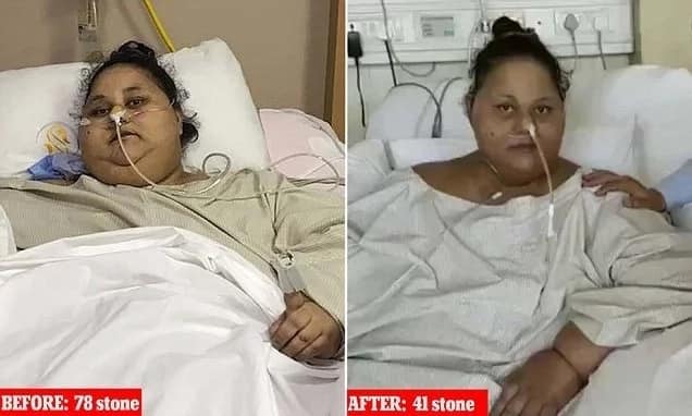 World's heaviest woman sits up for first time after losing HALF her 500kg weight (photos)