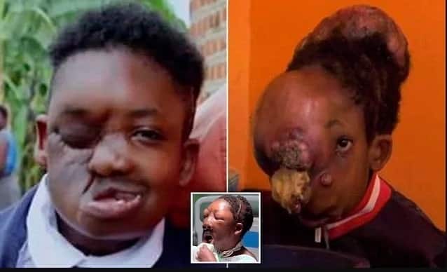 Not a happy ending! Boy, 17, with NO FACE loses his battle for life (photos, video)