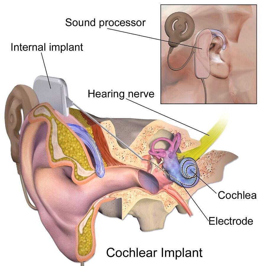 MP Shah hospital performs historic first ever ear operation on five patients