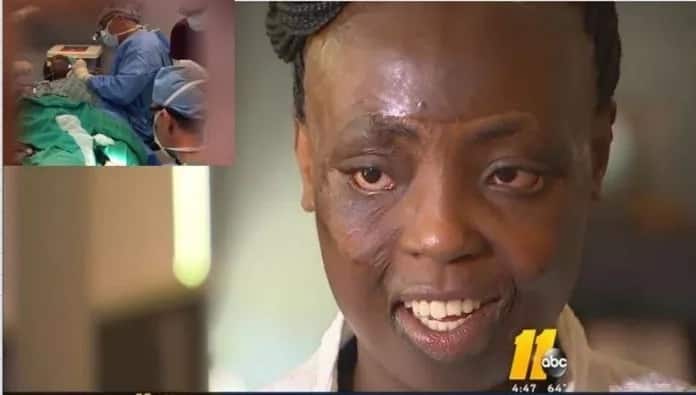 God is great! Murang’a woman burned as baby gets life-changing surgery in US for FREE (photos, video)
