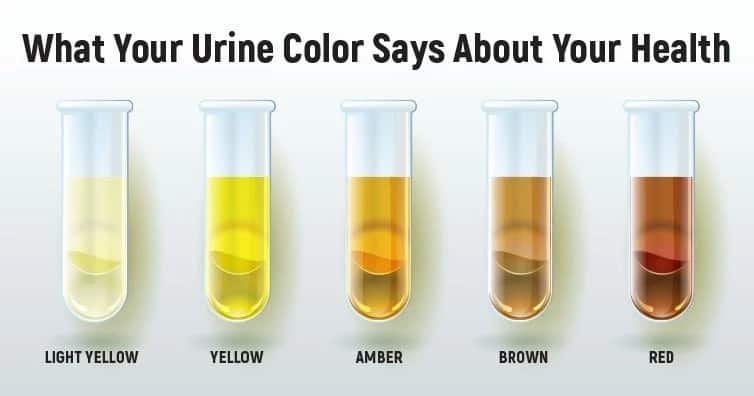 8 urine colours and what each say about your health