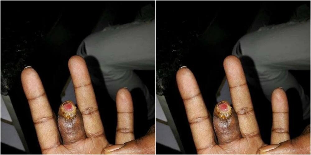 Governor Ken Lusaka's aide bites off dancer's finger