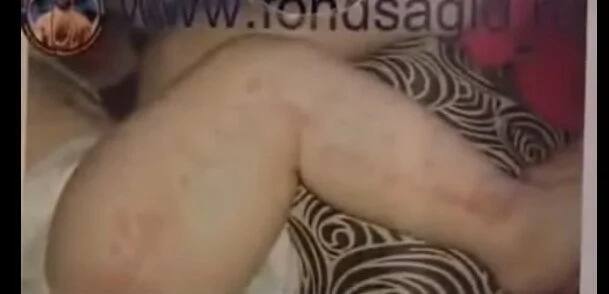 Allah's mircale! Quranic verses appear on BABY's skin (see photos, video)