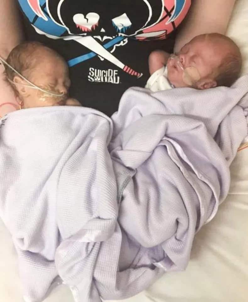 Mom expected a stillbirth, but instead receives MIRACLE twins (photos)