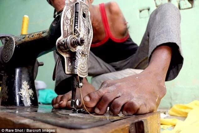 He is now adept at stitching using his feet. Photo: Barcroft Images