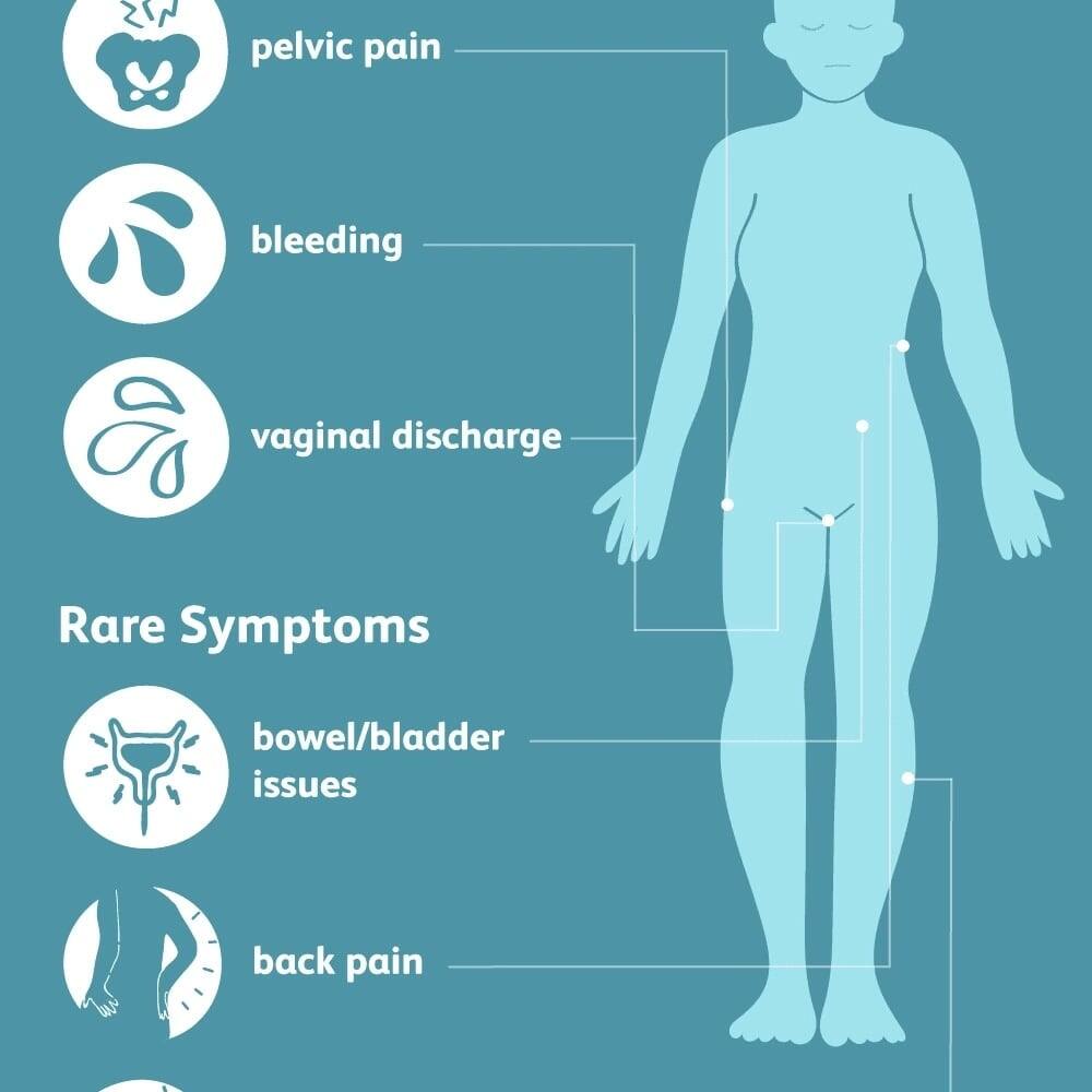 Symptoms And Signs Of Cervical Cancer Ke