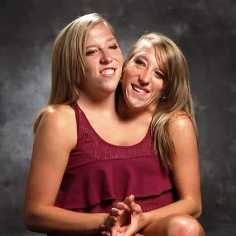 Understanding The Abby And Brittany Hensel Family Tragedy