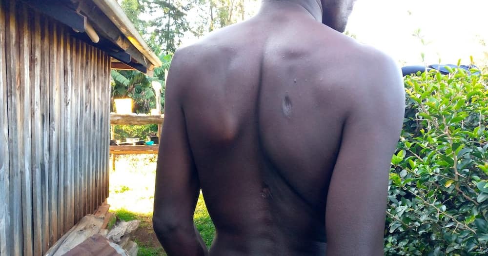 Kericho Man with 2 Bullets Lodged in His Chest for 14 Years Seeks Help: "I Am Worried"