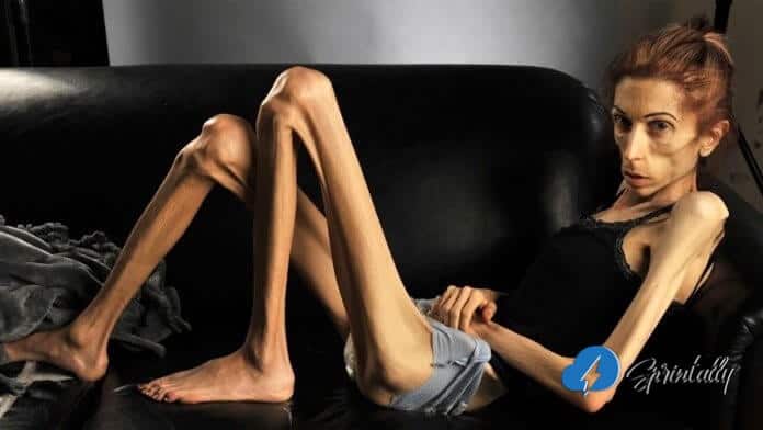 Frightening words of 4st anorexic Valeria Levitin who gets FAN MAIL because  she's so thin