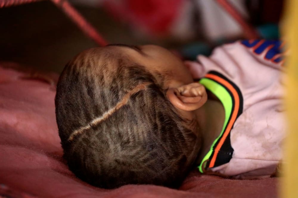 Talab, the son of Awadya Ahmed, lies on a bed in the village of Banat in River Nile state. Ahmed is not the only one of Banat's 8,000 residents to have observed birth defects and miscarriages