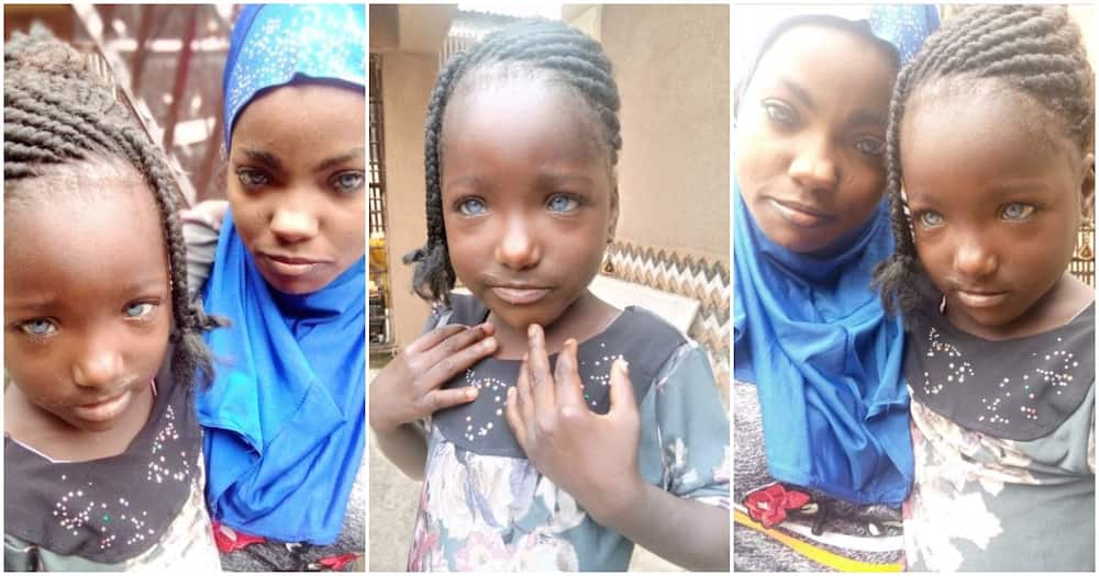 Father reportedly abandons daughters over their unique eye colour (photos)