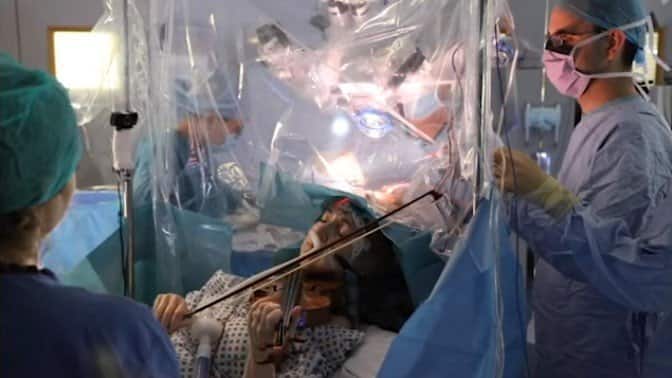 Patient plays violin during brain surgery so doctors don't damage her motor skills