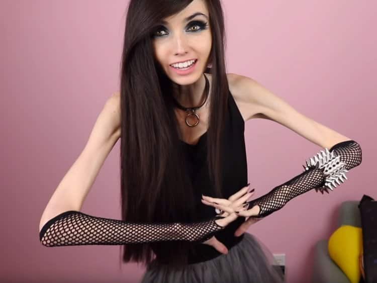 Eugenia Cooney before and after anorexia