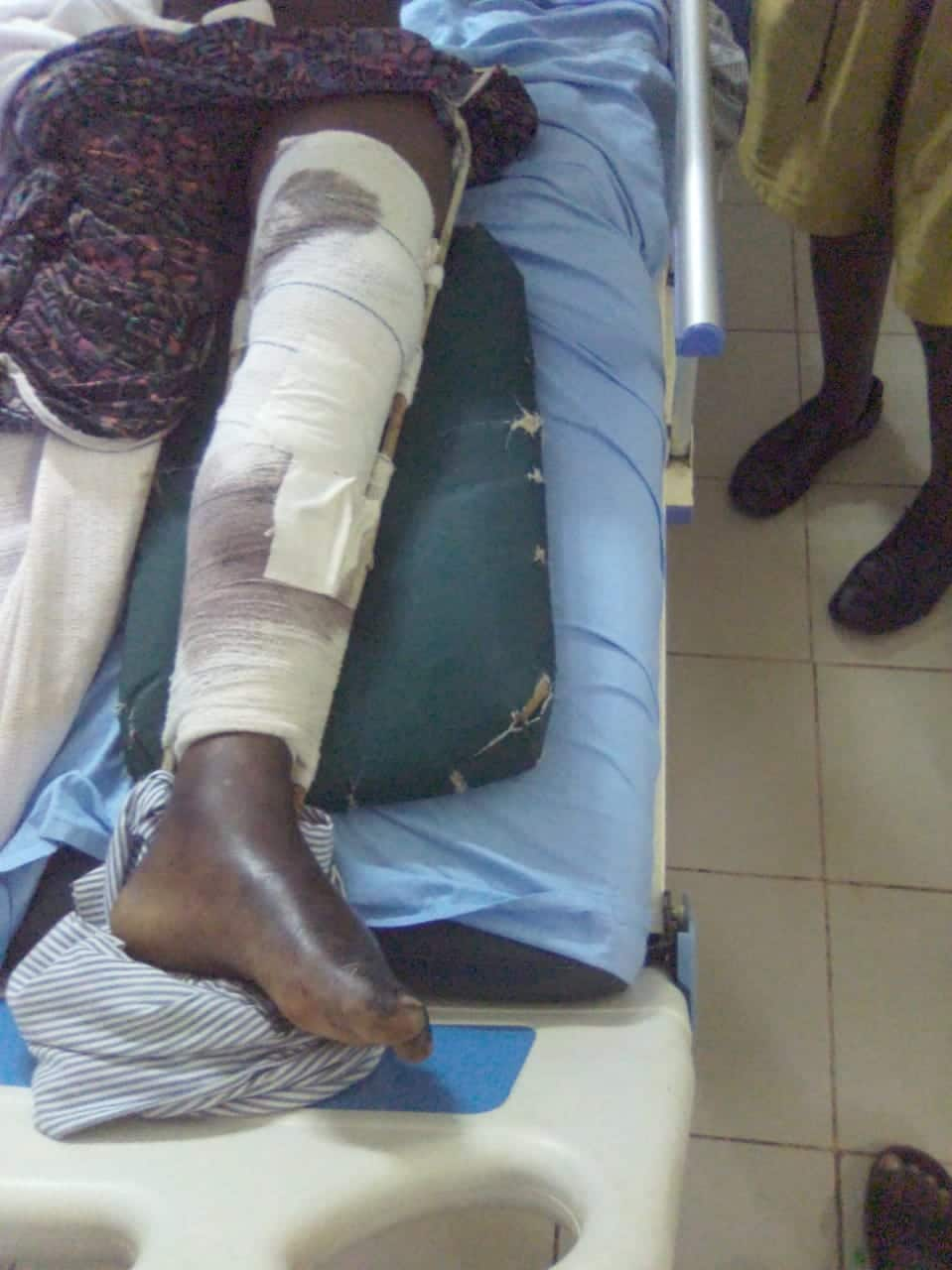 Vihiga Family in Rush to Raise KSh 200k for Kin Involved in Bodaboda Crash, Risks Amputation