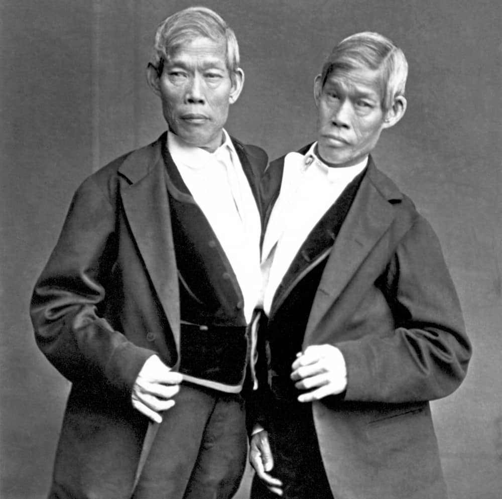Famous Siamese twins