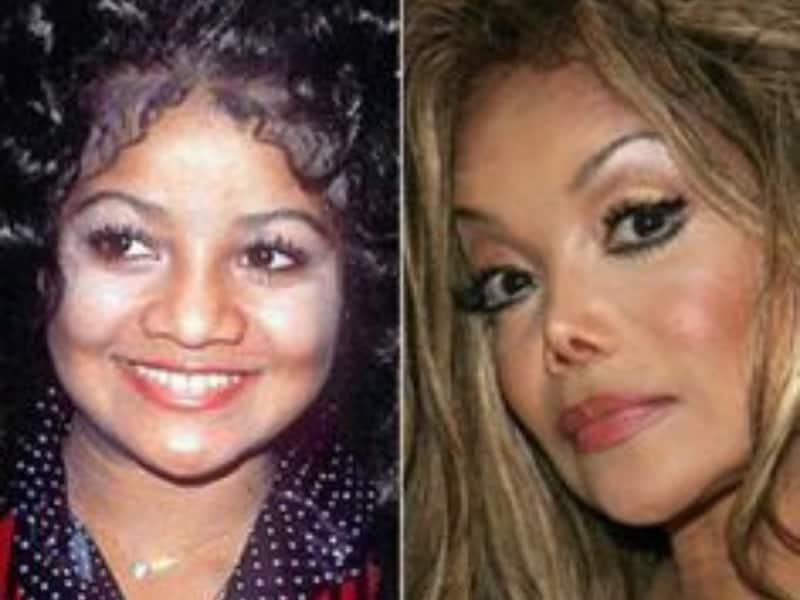 skin bleached celebrities