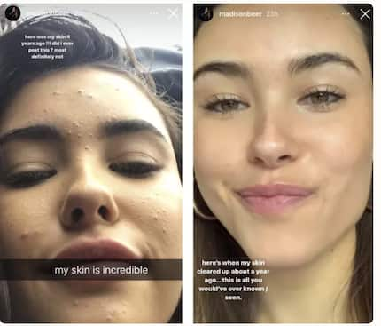 Madison Beer no-makeup look: 7 photos of her natural beauty - Tuko.co.ke