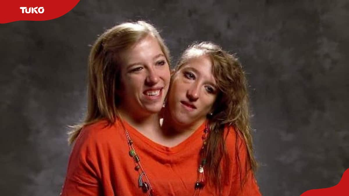 Amazing story of conjoined twins Abigail and Brittany Hensel