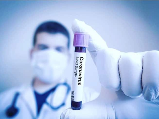 First COVID-19 vaccine trial begins in South Africa this week
