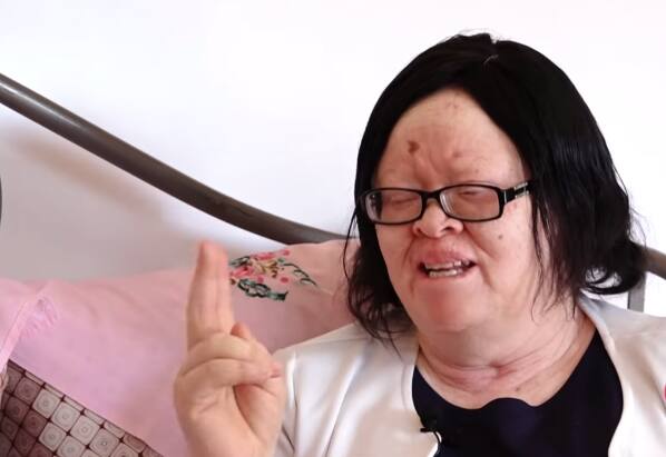 Woman says lover left her days to their traditional marriage ceremony over albinism