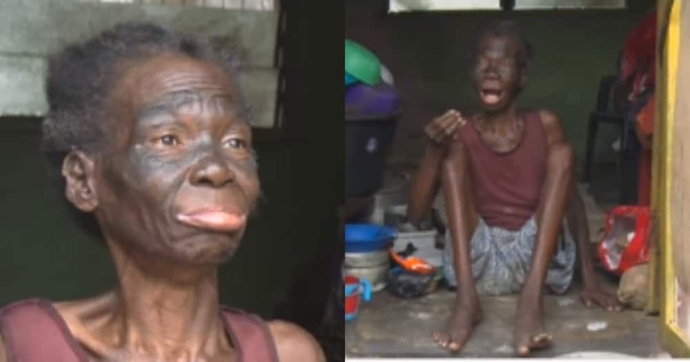 40-year-old crippled woman begs for help to care for her child with disability
