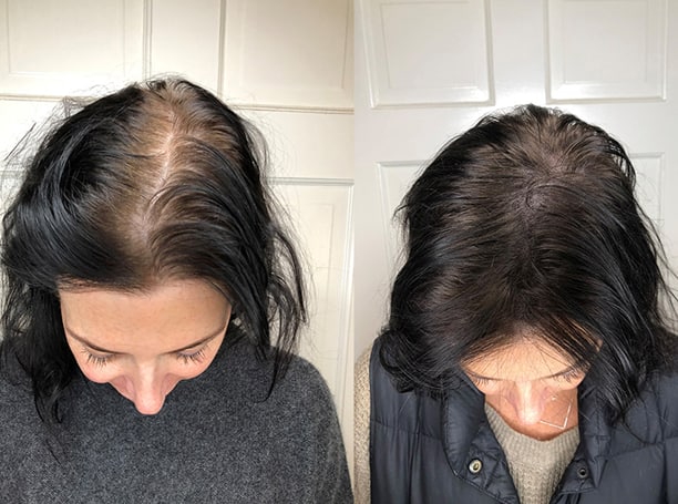 8 tips on how to use coffee for hair growth(before and after pics) -  