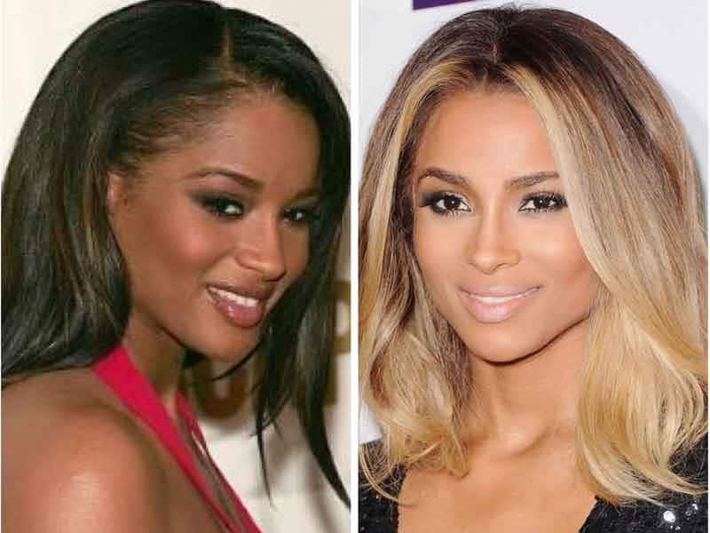 celebrity skin bleaching