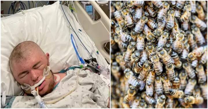 Man, 20, out of Coma After Being Stung by Bees 20,000 Times and