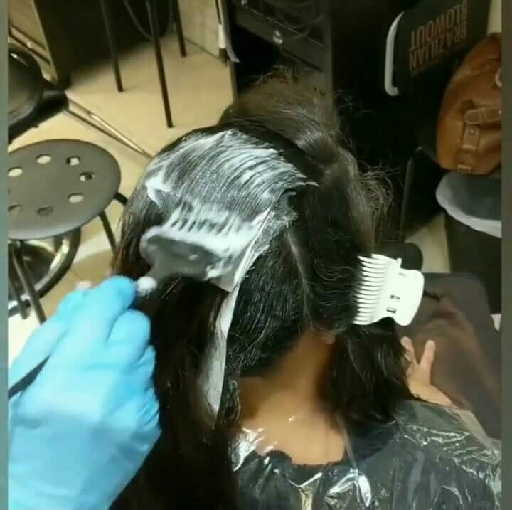 scalp burn from relaxer