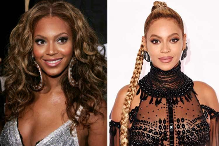 beyonce then and now skin