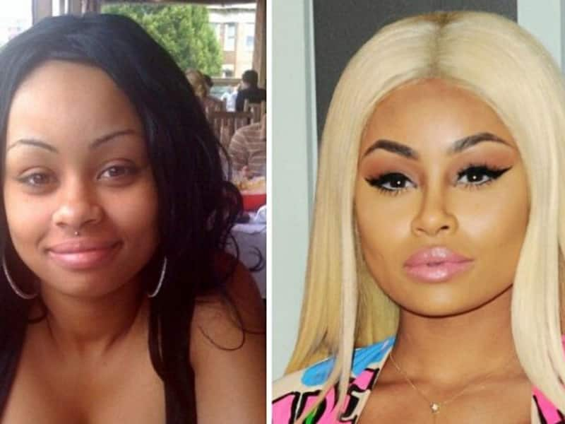 vera sidika bleaching before and after