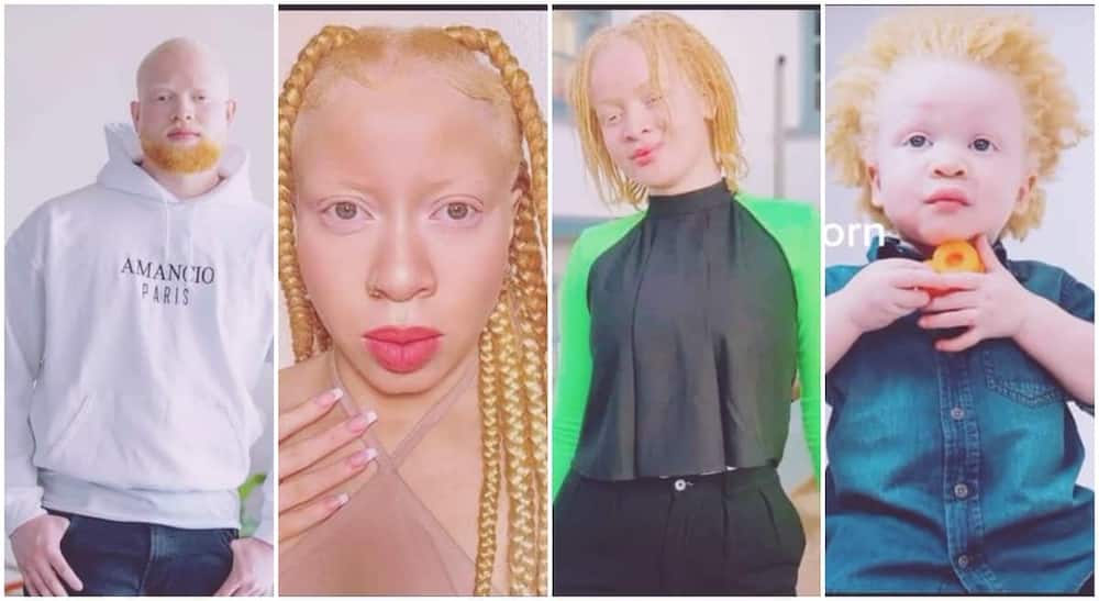 Photos of four siblings who are all albinos.
