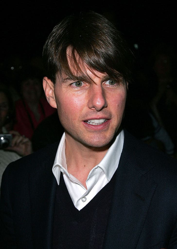 Tom cruise's teeth before and after