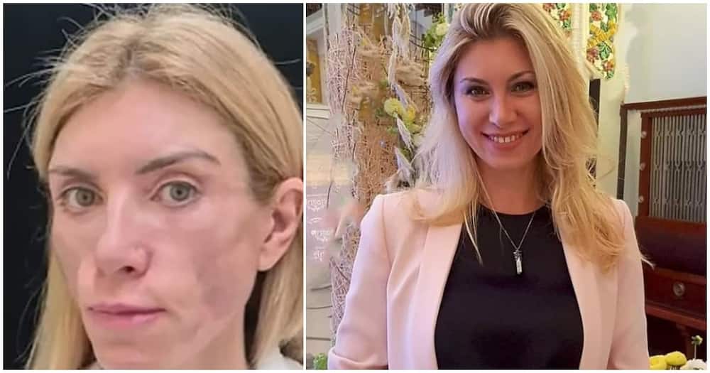 43-year-old beauty queen who cannot smile or close her eyes again after undergoing plastic surgery.