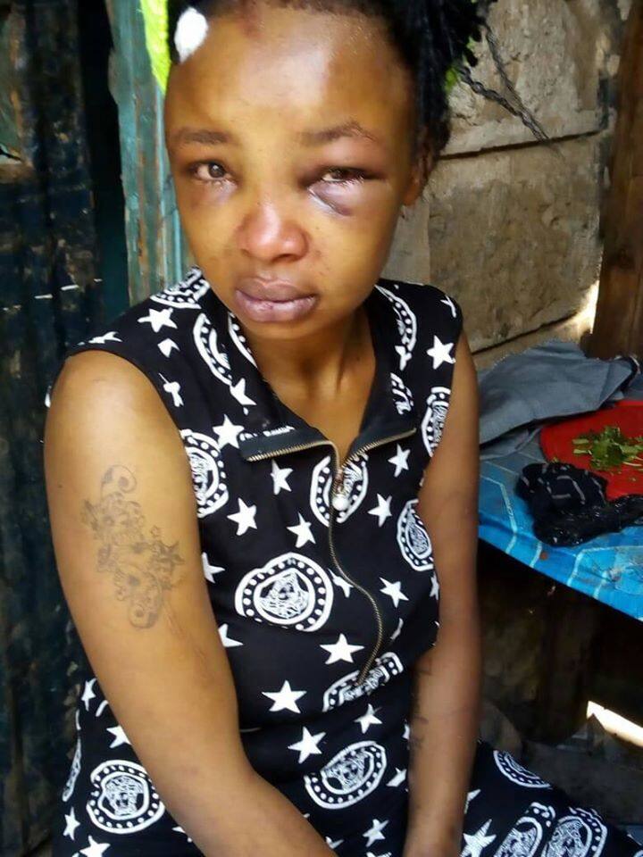 Nairobi woman cries for justice after enduring years of violence at hands of baby daddy