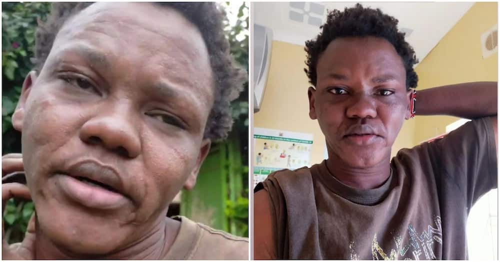 Meru TikToker Shares Video of Swollen Face, Claims Its Reaction After Eating Spider.