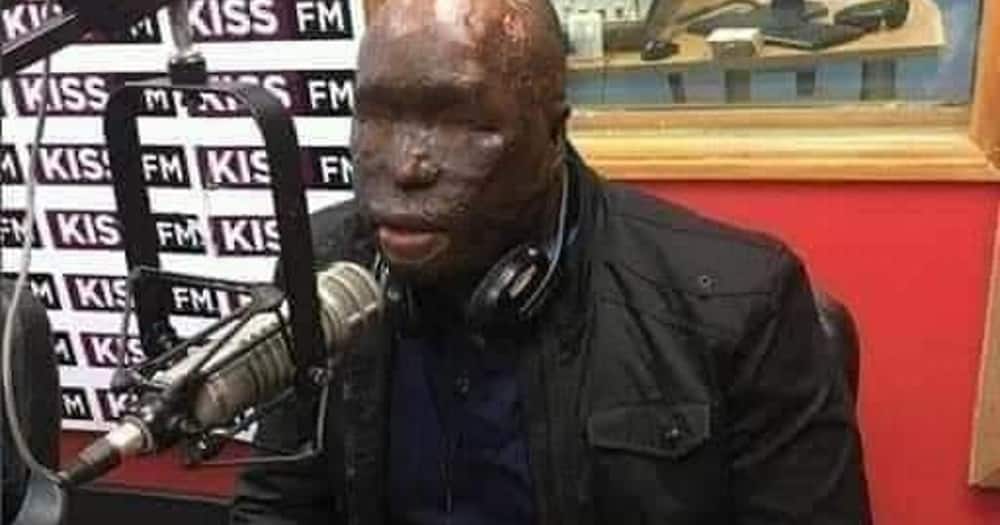 Kenyan Police Officer Who Survived Wife's Acid Attack Asks Couples to Be Wary of Suspicious Partners.