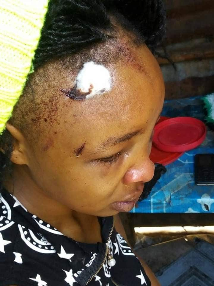 Nairobi woman cries for justice after enduring years of violence at hands of baby daddy