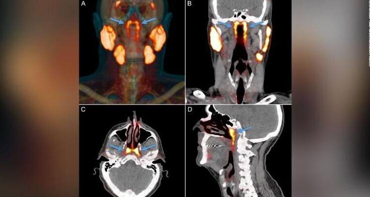 Scientists believe they moisten and lubricate the upper throat behind the nose and mouth. Photo: WDRB