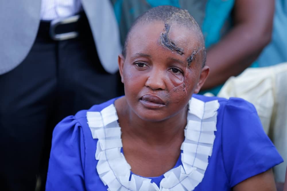 Jackline Mwende ditches prosthetic limps, says too expensive to maintain