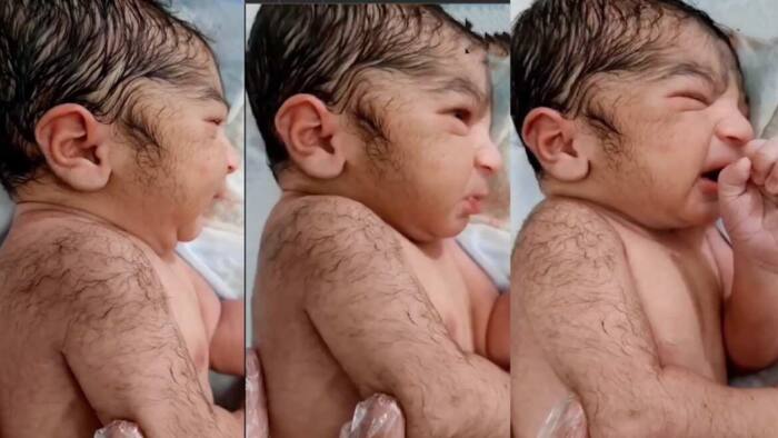 New Born Baby with Ample Hair on His Body and Face Goes Viral